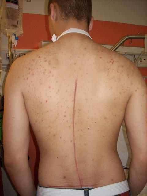 scheve noel.JPG
